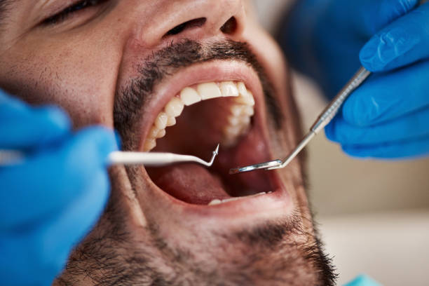 Best Dental Abscess Treatment in Mccook, NE